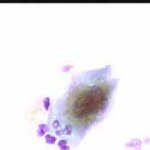 Πολυπύρηνο κυτταρο. 1997